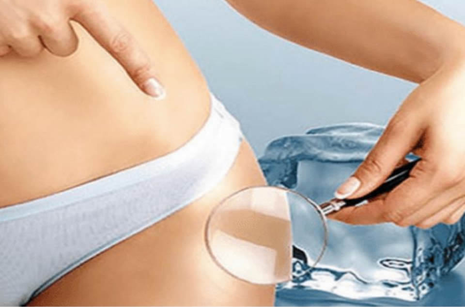 cure_minceur_cryoliplyse_lecrinparisien_marrakech
